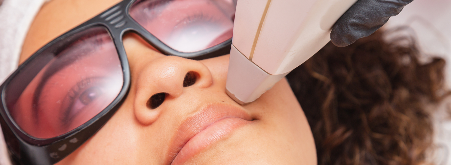 Laser Hair Removal in Bowie, MD | RoseHall Medical Aesthetics
